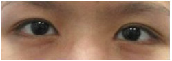 Patient Case #10634 — before