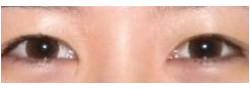 Patient Case #10637 — after