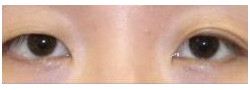 Patient Case #10637 — before