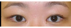 Patient Case #10640 — after