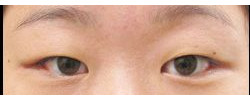 Patient Case #10640 — before