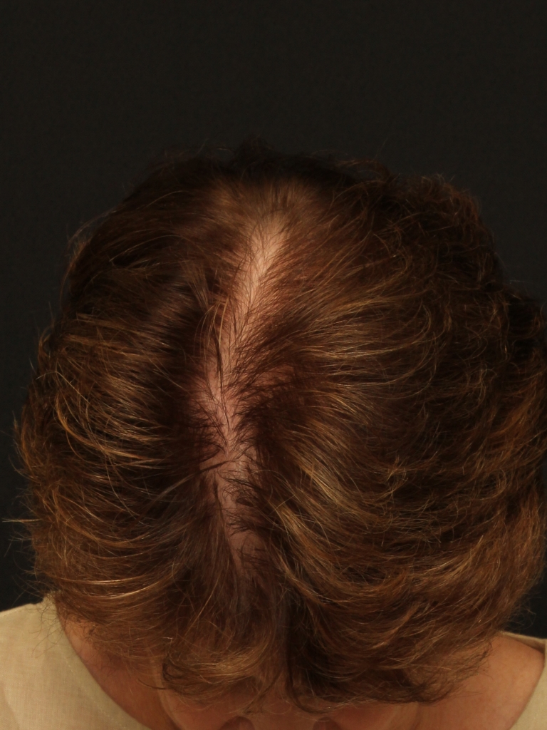 Patient Case #11214 — after