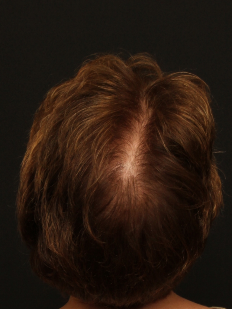 Patient Case #11214 — after