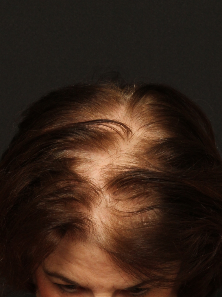Patient Case #11214 — before