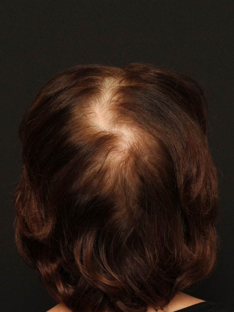Patient Case #11214 — before