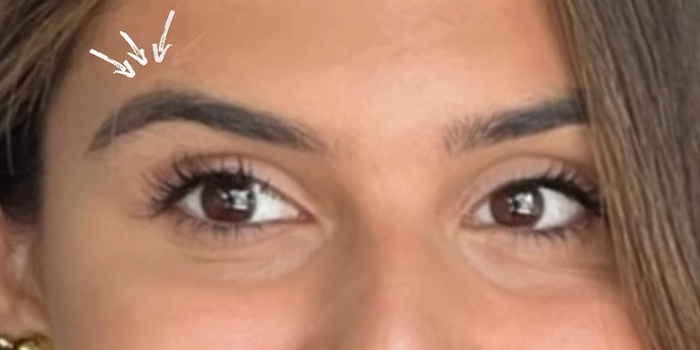 Patient Case #12665 — after