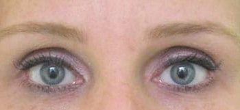 Patient Case #10940 — after