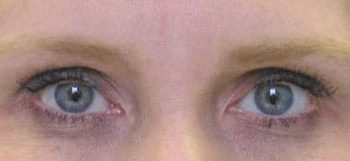 Patient Case #10940 — before