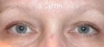 Patient Case #10943 — after