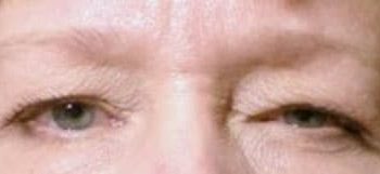 Patient Case #10943 — before