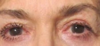 Patient Case #10946 — after