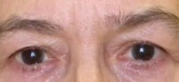 Patient Case #10946 — before