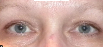Patient Case #12650 — after