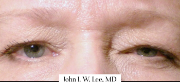 Patient Case #12650 — before