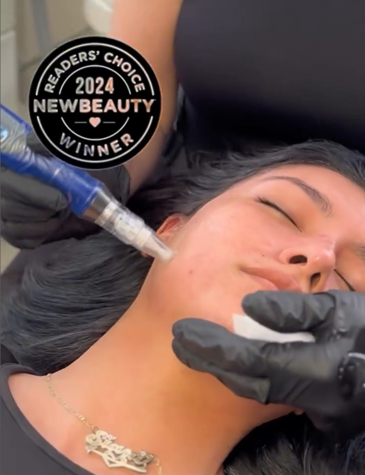 microneedling