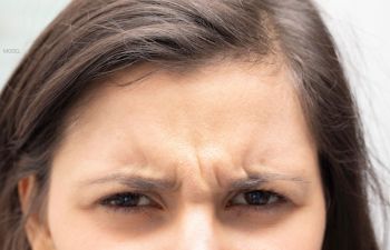 Dr. Lee’s Brow Lift