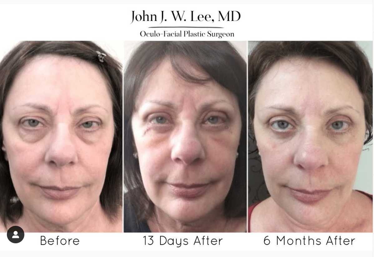 Facial Cosmetic Surgery | Bryn Mawr & Main Line | Dr. John . Lee