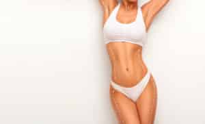 Woman body in perfect form, cosmetic cellulite treatment