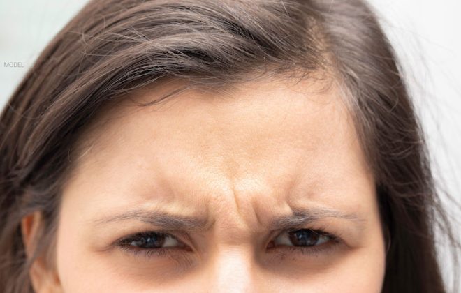 Close up image of a young woman with frown lines on her forehead and between her eyes